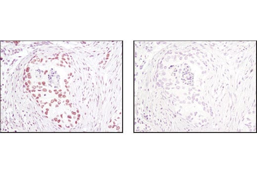 Immunohistochemistry Image 1: CTCF (D31H2) Rabbit Monoclonal Antibody (BSA and Azide Free)