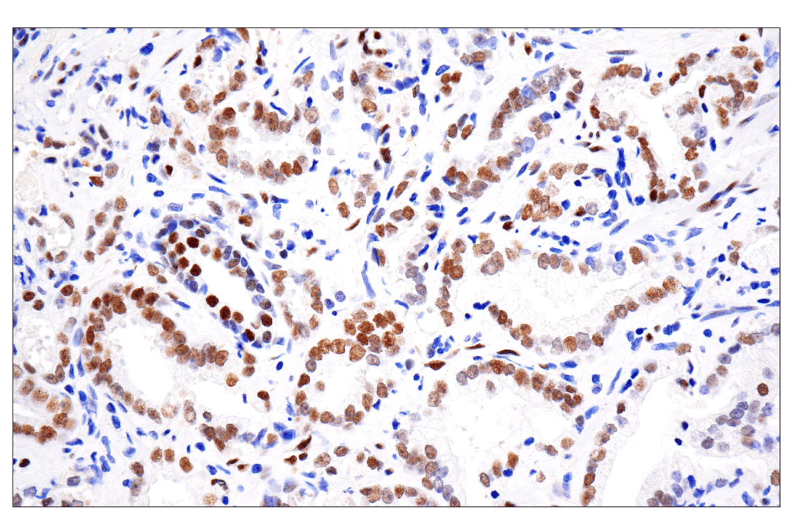 undefined Image 23: ALK Activation Antibody Sampler Kit