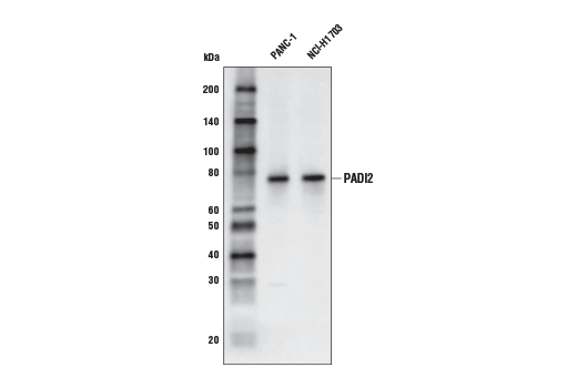 Western Blotting Image 1: PADI2 (E3P8Z) Rabbit mAb