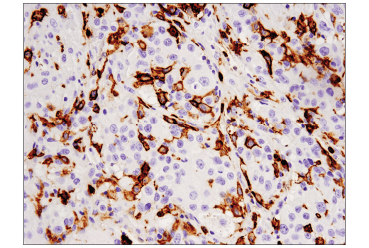 Immunohistochemistry Image 2: CD16 (D1N9L) Rabbit Monoclonal Antibody