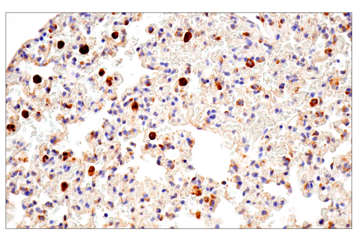 Immunohistochemistry Image 3: Cathepsin D (E7Z4L) XP<sup>®</sup> Rabbit mAb (BSA and Azide Free)