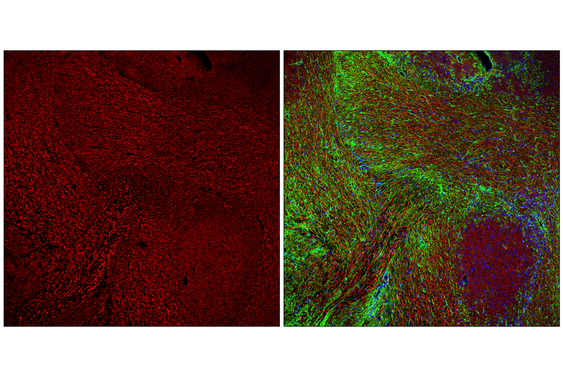 Immunofluorescence Image 2: Neurofilament-H (E7Z7G) Rabbit Monoclonal Antibody (BSA and Azide Free)