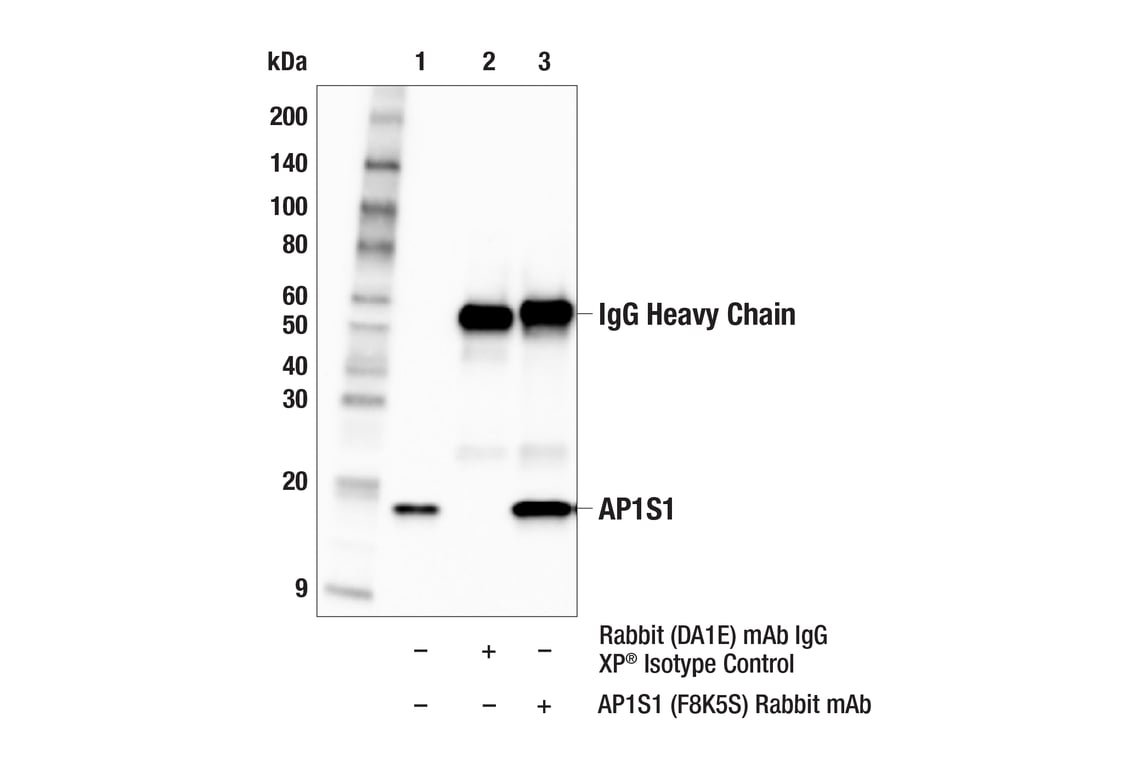 Immunoprecipitation Image 1: AP1S1 (F8K5S) Rabbit Monoclonal Antibody