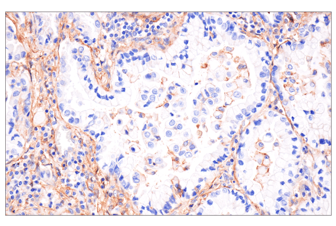 Immunohistochemistry Image 2: B7-H3 (D9M2L) Rabbit Monoclonal Antibody