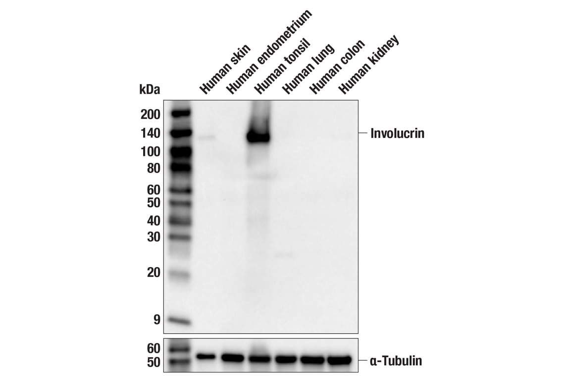 Western Blotting Image 2: Involucrin (F9C3C) Rabbit Monoclonal Antibody