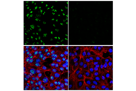 Immunofluorescence Image 1: NOP2 (E9Z4D) Rabbit Monoclonal Antibody