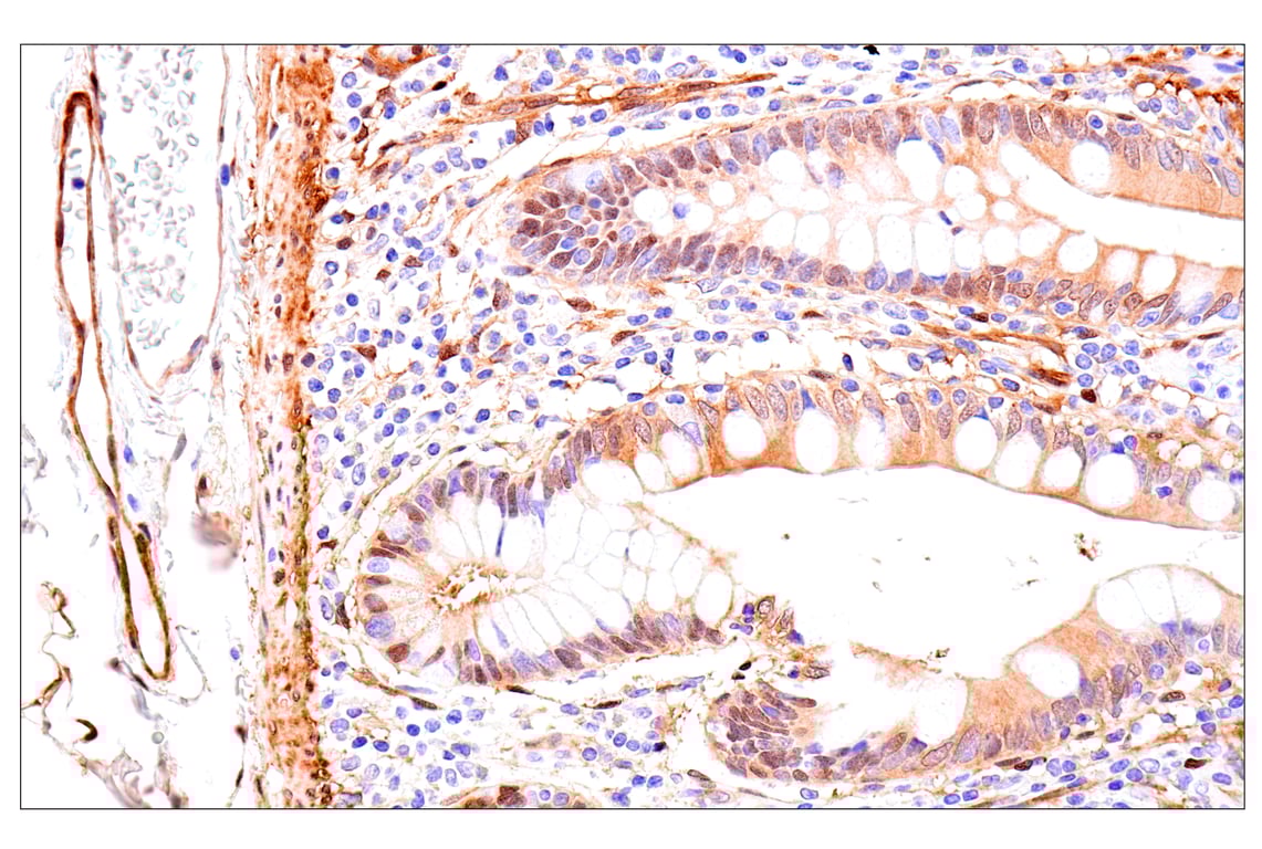 Immunohistochemistry Image 7: Phospho-YAP (Ser61) (E4Q8S) Rabbit Monoclonal Antibody