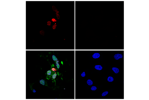 Immunofluorescence Image 2: TUNEL Assay Kit (Fluorescence, 640 nm)