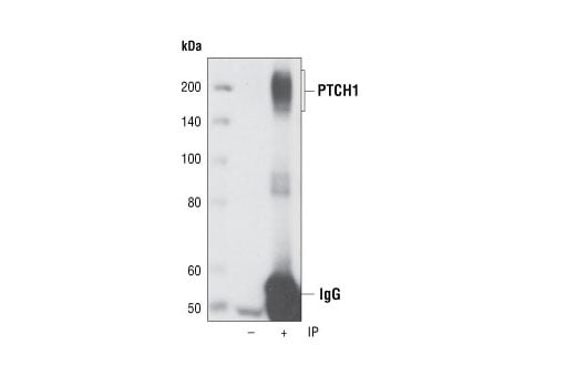 Immunoprecipitation Image 1: PTCH1 (C53A3) Rabbit Monoclonal Antibody