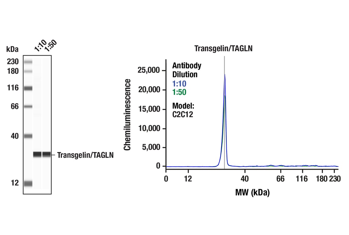 Western Blotting Image 1: Transgelin/TAGLN (F3B7H) Rabbit Monoclonal Antibody