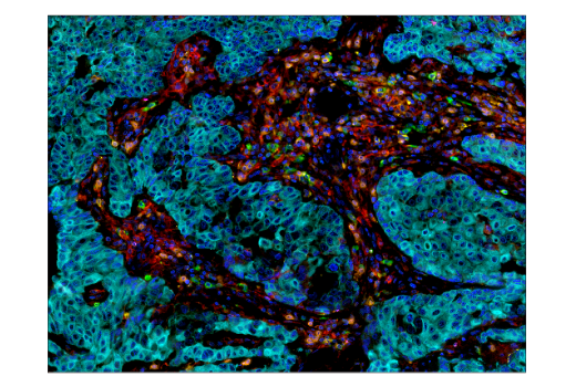 Immunohistochemistry Image 4: TIM-3 (D5D5R) Rabbit Monoclonal Antibody (BSA and Azide Free)