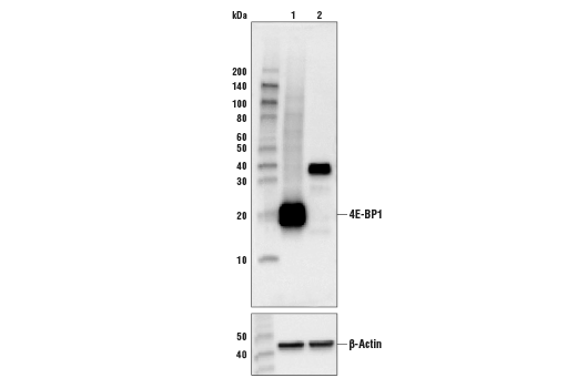 Western Blotting Image 1: 4E-BP1 (53H11) Rabbit mAb