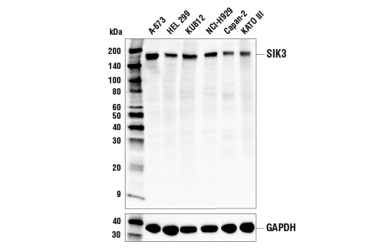 Western Blotting Image 2: SIK3 Antibody