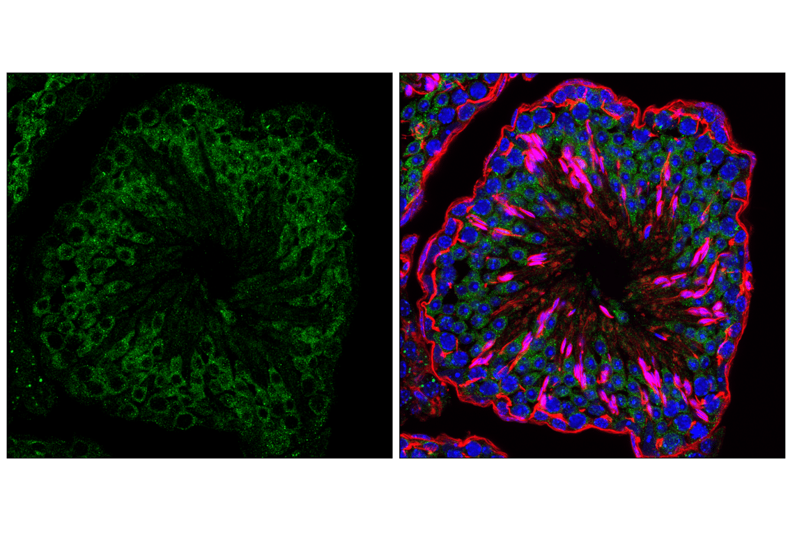 Immunofluorescence Image 1: UFL1 (F5P6L) Rabbit Monoclonal Antibody