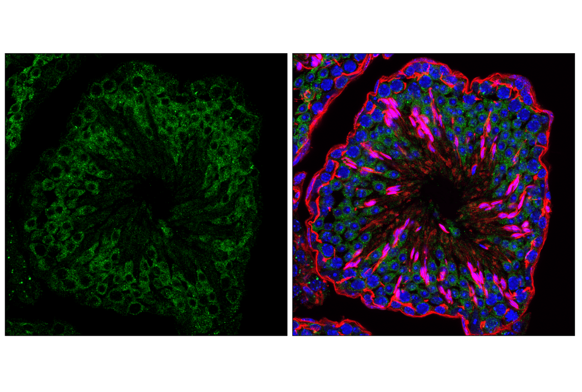 Immunofluorescence Image 1: UFL1 (F5P6L) Rabbit mAb