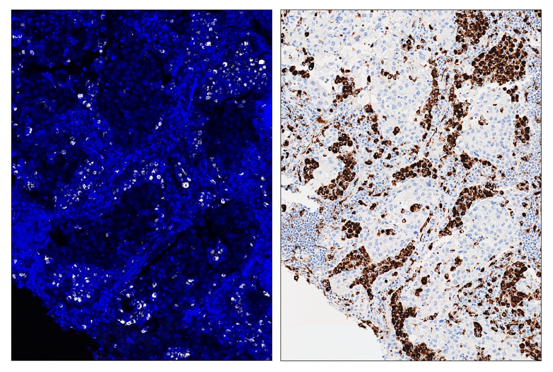 Immunohistochemistry Image 6: CD68 (D4B9C) & CO-0007-647 SignalStar<sup>™</sup> Oligo-Antibody Pair