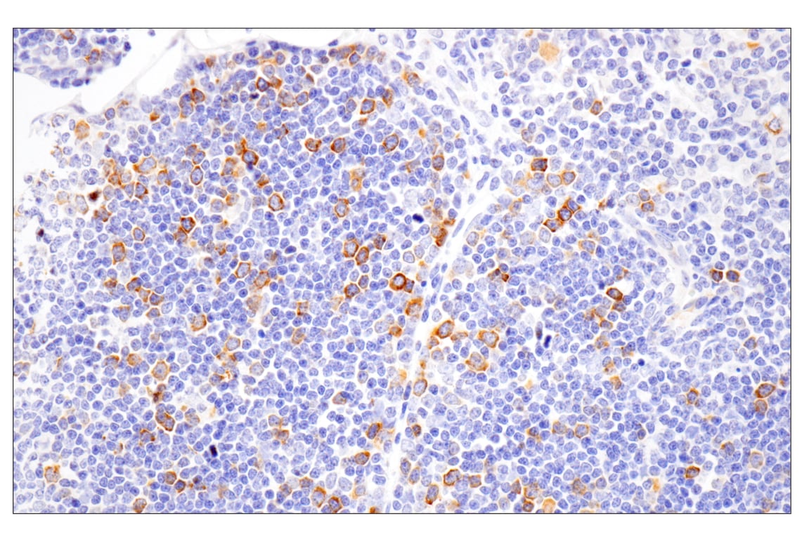 Immunohistochemistry Image 5: Eg5 (E1L3W) Rabbit Monoclonal Antibody