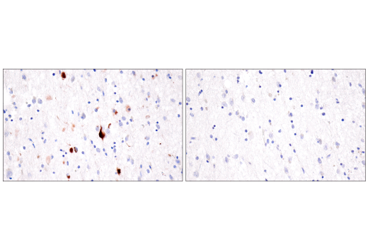 Immunohistochemistry Image 3: Tau (GT-38) Mouse Monoclonal Antibody (BSA and Azide Free)