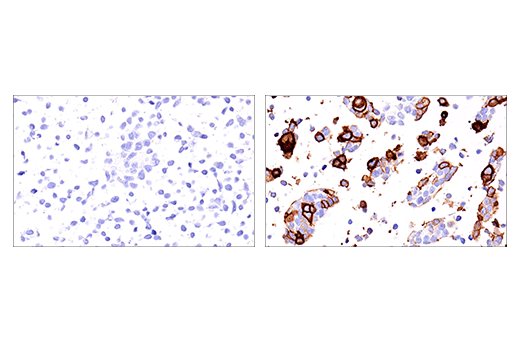 Immunohistochemistry Image 5: NK1.1/CD161 (E6Y9G) Rabbit Monoclonal Antibody