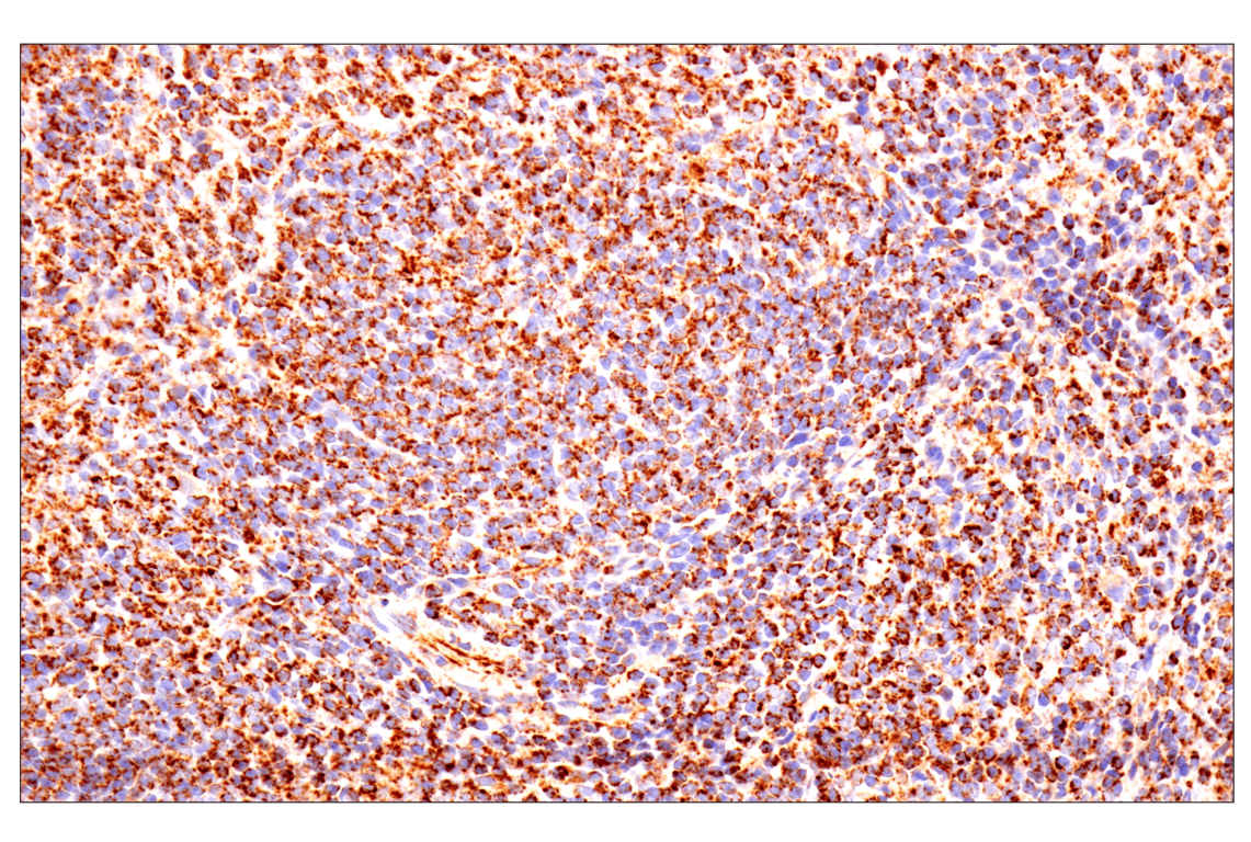 Immunohistochemistry Image 4: TSPO (F5B8F) Rabbit Monoclonal Antibody