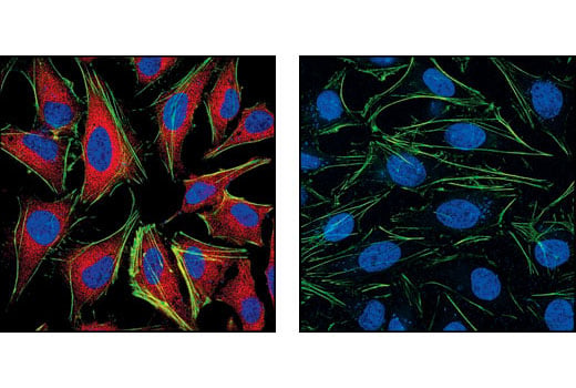 Immunofluorescence Image 1: MEK1/2 (L38C12) Mouse Monoclonal Antibody (BSA and Azide Free)