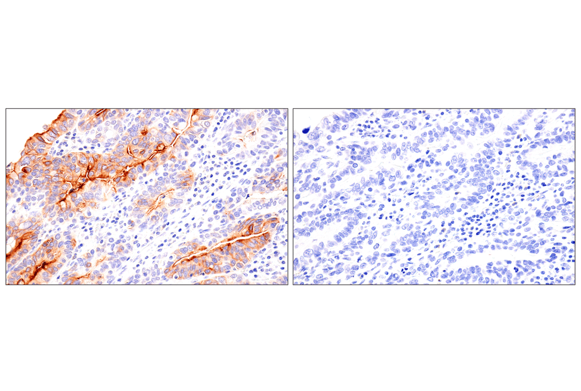 Immunohistochemistry Image 6: Folate Receptor Alpha/FOLR1 (BN3.2) Mouse Monoclonal Antibody