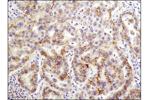 undefined Image 31: Epithelial-Mesenchymal Transition (EMT) Antibody Sampler Kit