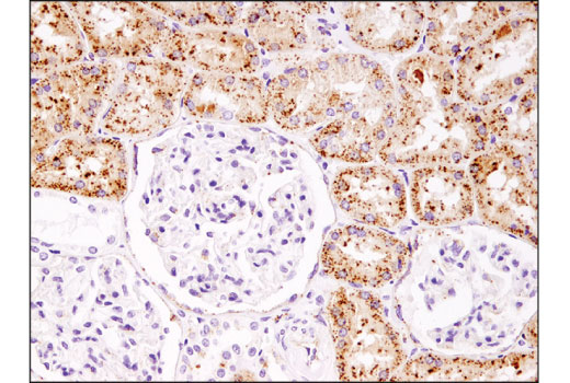Immunohistochemistry Image 2: Cathepsin B (D1C7Y) Rabbit Monoclonal Antibody (BSA and Azide Free)