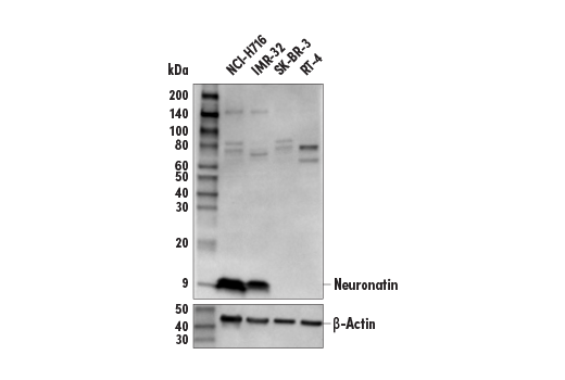 Western Blotting Image 2: Neuronatin Antibody