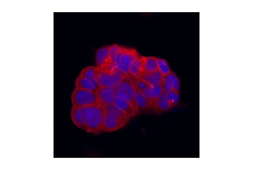 Immunofluorescence Image 1: Src (36D10) Rabbit Monoclonal Antibody (BSA and Azide Free)