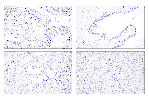 Immunohistochemistry Image 7: MAGE-A10 (E9V2Q) Rabbit Monoclonal Antibody (BSA and Azide Free)