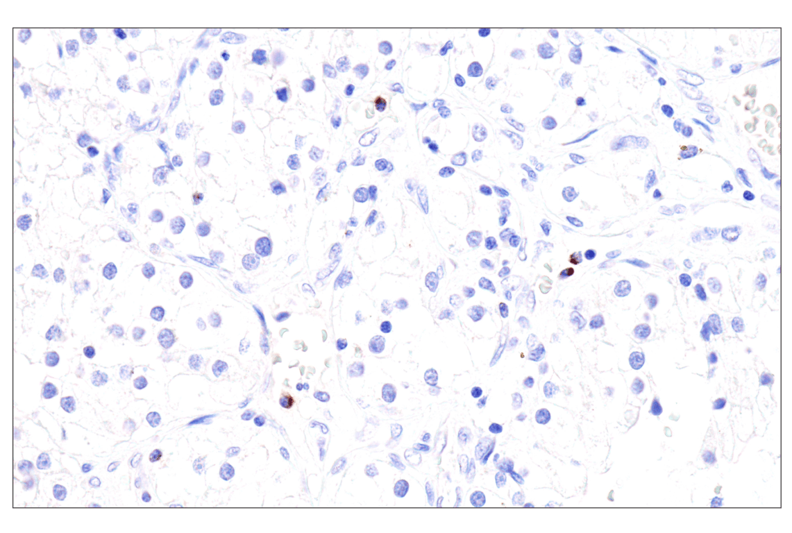 Immunohistochemistry Image 4: Perforin (IHC646) Mouse Monoclonal Antibody