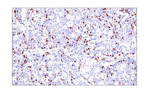 Immunohistochemistry Image 3: Geminin (E5Q9S) XP<sup>®</sup> Rabbit mAb (BSA and Azide Free)