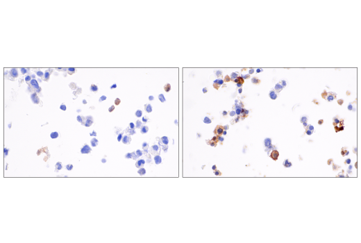 undefined Image 27: Gasdermin Family Antibody Sampler Kit