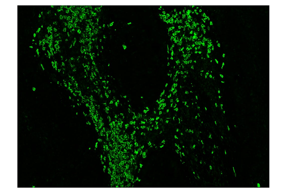 Immunohistochemistry Image 2: CD20 (E7B7T) & CO-0011-488 SignalStar<sup>™</sup> Oligo-Antibody Pair