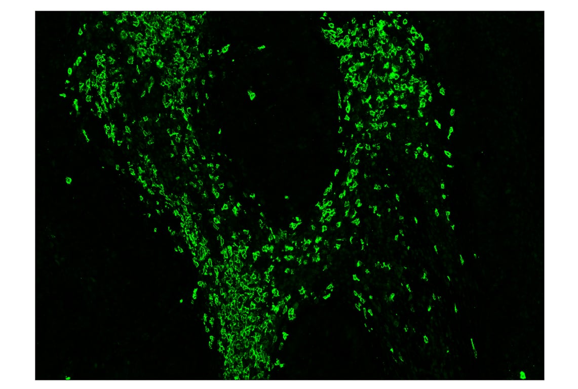 Immunohistochemistry Image 2: CD20 (E7B7T) & CO-0011-594 SignalStar<sup>™</sup> Oligo-Antibody Pair