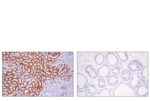 Immunohistochemistry Image 5: AQP4 (D1F8E) Rabbit Monoclonal Antibody (BSA and Azide Free)