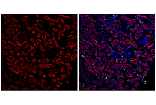 Immunofluorescence Image 4: Cathepsin D (E7Z4L) XP<sup>®</sup> Rabbit mAb (BSA and Azide Free)