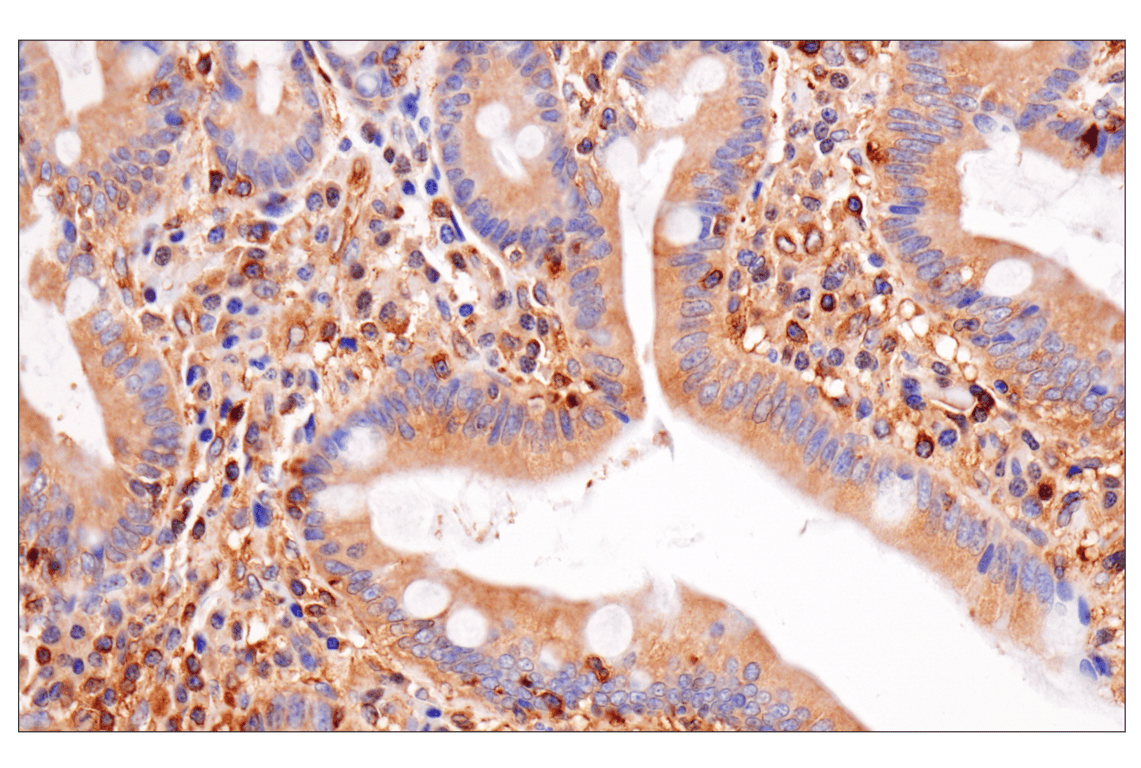 Immunohistochemistry Image 7: NF-kappaB p65 (D14E12) Rabbit Monoclonal Antibody (BSA and Azide Free)