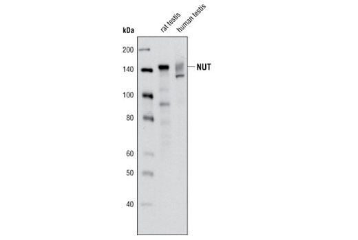 Western Blotting Image 2: NUT (C52B1) Rabbit Monoclonal Antibody