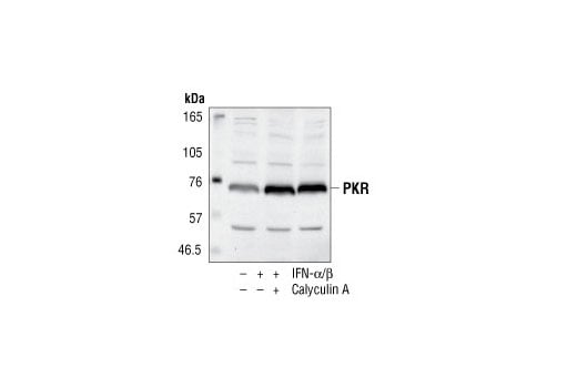 PKR Antibody | Cell Signaling Technology