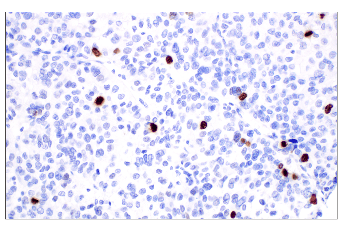 Immunohistochemistry Image 1: Phospho-Histone H3 (Ser10) (D7N8E) Rabbit Monoclonal Antibody (BSA and Azide Free)