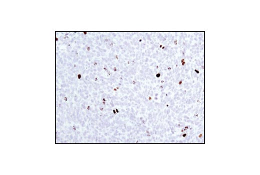 Immunohistochemistry Image 5: Phospho-Histone H3 (Ser10) Antibody
