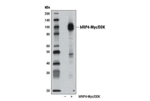 Western Blotting Image 2: RIP4 Antibody