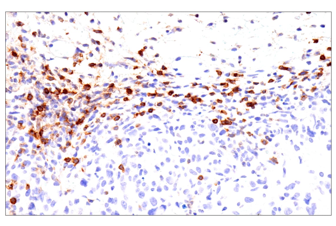 Immunohistochemistry Image 1: CD62L/L-Selectin (E7L2M) Rabbit Monoclonal Antibody