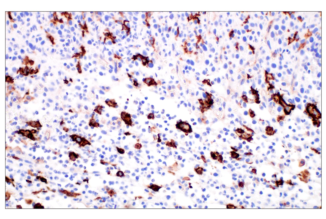 Immunohistochemistry Image 4: LYVE-1 (E5P8S) Rabbit Monoclonal Antibody
