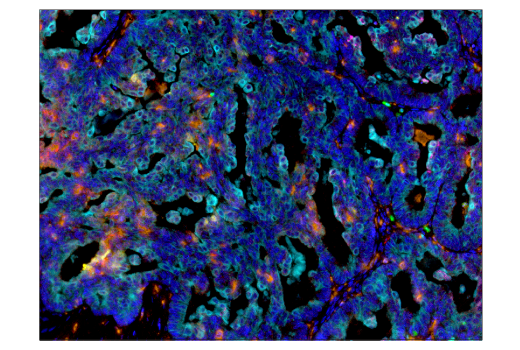 Immunohistochemistry Image 6: CD68 (D4B9C) Rabbit Monoclonal Antibody (BSA and Azide Free)