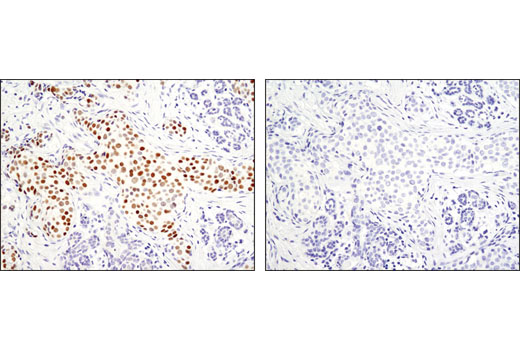 Immunohistochemistry Image 1: GATA-3 (D13C9) Rabbit Monoclonal Antibody (BSA and Azide Free)