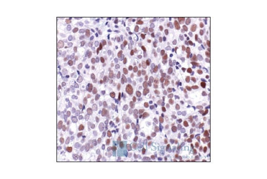 Immunohistochemistry Image 3: c-Jun (60A8) Rabbit Monoclonal Antibody