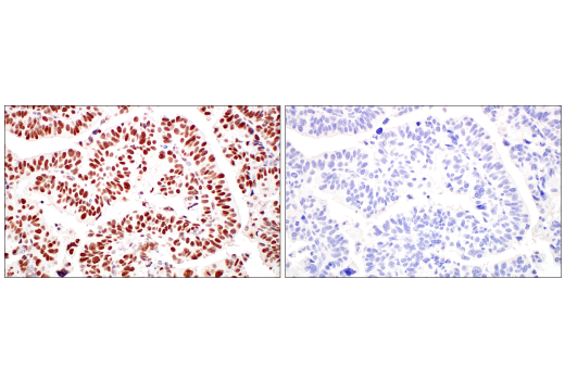 Immunohistochemistry Image 12: XRCC1 (E4A3V) Rabbit Monoclonal Antibody